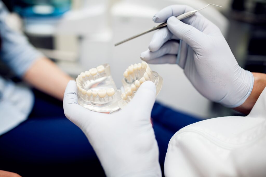 Dental implants Wattle Grove