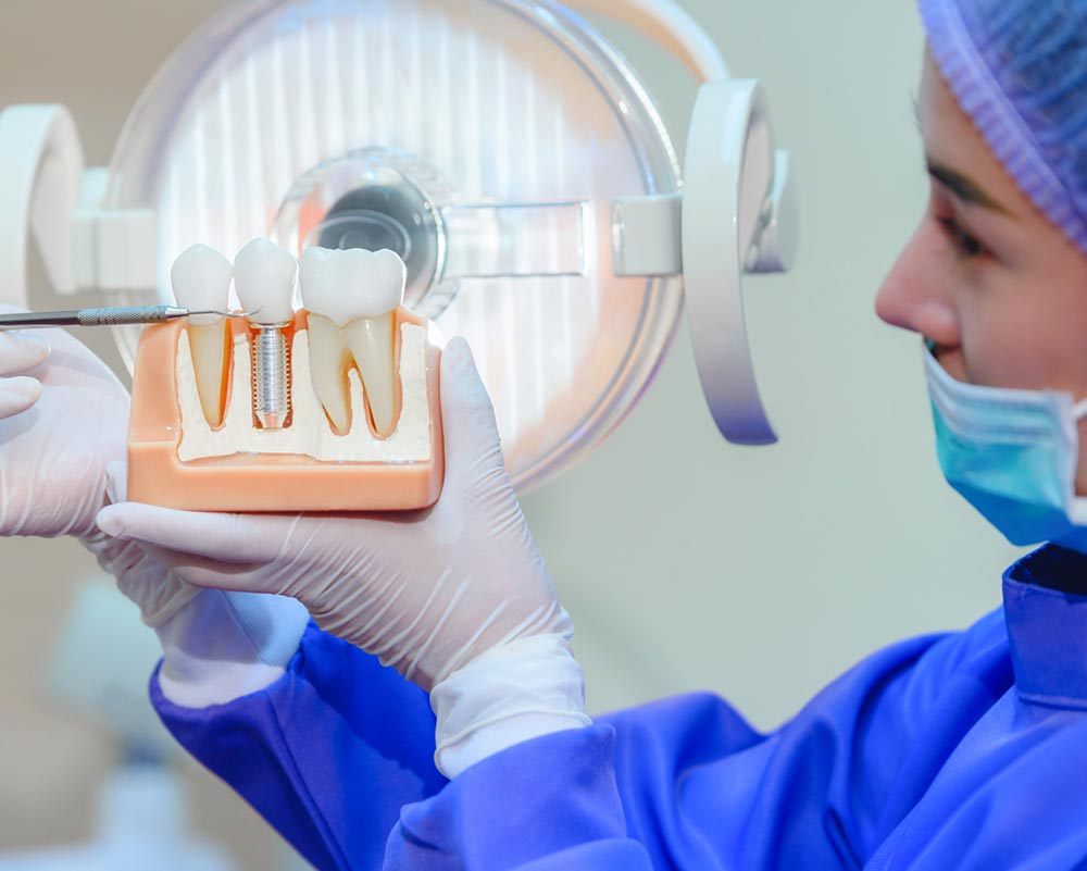 Dental Implants Kalamunda